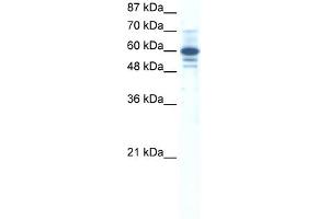 WB Suggested Anti-ZNF276 Antibody Titration:  0. (ZNF276 antibody  (Middle Region))