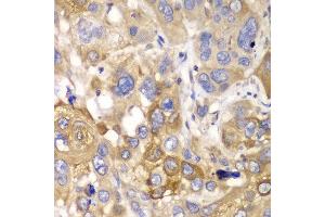 Immunohistochemistry (IHC) image for anti-Protein Phosphatase 1, Catalytic Subunit, beta Isoform (PPP1CB) (AA 1-327) antibody (ABIN3021409)