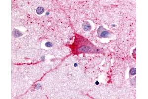 Anti-TRH Receptor antibody IHC of human brain, neurons and glia. (TRHR antibody  (Cytoplasmic Domain))