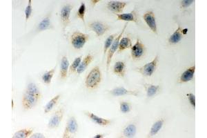 ICC testing of FFPE human HeLa cells with LYRIC antibody. (MTDH antibody  (AA 101-270))