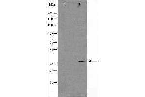 Western blot analysis on MCF7 cell lysate using BCL-2 Antibody，The lane on the left is treated with the antigen-specific peptide.