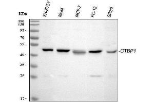 Western blot analysis of CTBP1 using anti-CTBP1 antibody (ABIN3043816).