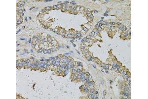 Immunohistochemistry of paraffin-embedded Human prostate using ALDH3A1 Polyclonal Antibody at dilution of 1:100 (40x lens). (ALDH3A1 antibody)