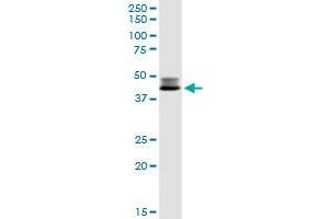 DLST MaxPab rabbit polyclonal antibody. (DLST antibody  (AA 1-453))