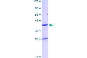 PFN2 Protein (AA 1-140) (GST tag)