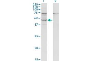 Western Blot analysis of STRADB expression in transfected 293T cell line by STRADB monoclonal antibody (M02), clone 3E11. (STRADB antibody  (AA 319-418))