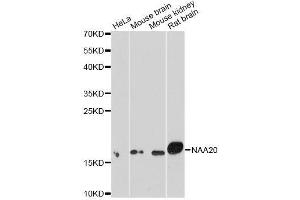 Western blot analysis of extracts of various cell lines, using NAA20 antibody. (NAT5 antibody  (AA 49-178))