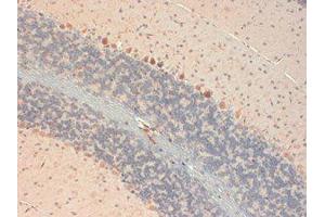 GluR2 Immunohistochemistry. (GRIA2 antibody  (C-Term))