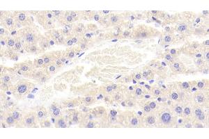 Immunohistochemistry (IHC) image for anti-Low Density Lipoprotein Receptor Adaptor Protein 1 (LDLRAP1) (AA 1-308) antibody (ABIN7440986)