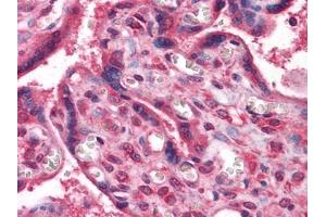 Immunohistochemical analysis of paraffin-embedded human Placenta tissues using anti-NME1 antibody (NME1 antibody)