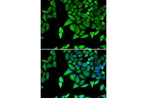 Immunofluorescence analysis of U2OS cells using NPPA antibody. (NPPA antibody  (AA 26-151))