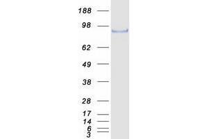 Western Blotting (WB) image for SRY (Sex Determining Region Y)-Box 5 (SOX5) (Transcript Variant 1) protein (Myc-DYKDDDDK Tag) (ABIN2732464)