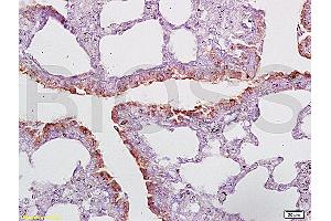 Formalin-fixed and paraffin embedded rat lung tissue labeled with Anti-CD2AP Polyclonal Antibody (ABIN669486), Unconjugated at 1:200, followed by conjugation to the secondary antibody and DAB staining (CD2AP antibody  (AA 561-641))