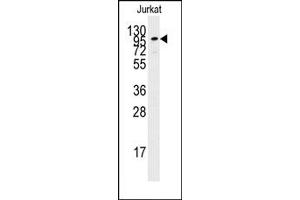 Image no. 1 for anti-Adenylate Cyclase 2 (Brain) (ADCY2) (C-Term) antibody (ABIN357898) (ADCY2 antibody  (C-Term))