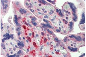 Human Placenta: Formalin-Fixed, Paraffin-Embedded (FFPE) (YES1 antibody  (AA 284-541))