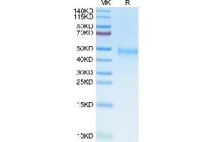 IL21 Receptor Protein (AA 20-232) (His tag)