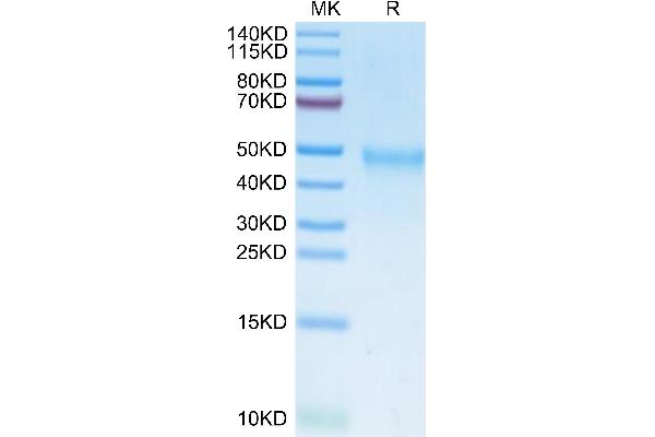 IL21 Receptor Protein (AA 20-232) (His tag)