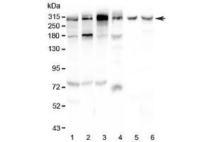 Western blot testing of human 1) HeLa, 2) U-87 MG, 3) HepG2, 4) 22RV1, 5) rat brain and 6) mouse brain lysate with M6PR antibody at 0. (IGF2R antibody)