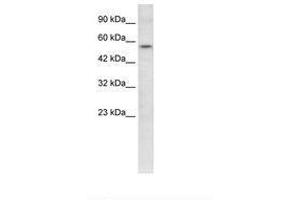 Image no. 3 for anti-V-Ets erythroblastosis Virus E26 Oncogene Homolog 1 (Avian) (ETS1) (AA 52-101) antibody (ABIN202532) (ETS1 antibody  (AA 52-101))