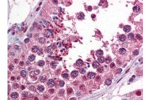 Immunohistochemistry (IHC) image for anti-Calcium/calmodulin-Dependent Protein Kinase II beta (CAMK2B) (AA 1-504) antibody (ABIN614553) (CAMK2B antibody  (AA 1-504))
