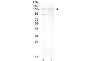Western blot testing of rat 1) testis and 2) PC-12 lysate with RTEL1 antibody at 0. (RTEL1 antibody)