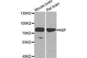 Western blot analysis of extracts of various cell lines, using NSF antibody (ABIN5974702) at 1/1000 dilution. (NSF antibody)