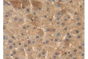 Detection of BMP4 in Human Liver Tissue using Polyclonal Antibody to Bone Morphogenetic Protein 4 (BMP4) (BMP4 antibody  (AA 22-408))