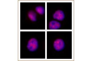 MOF / MYST1 antibody (pAb) tested by Immunofluorescence. (MYST1 antibody  (N-Term))