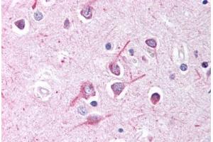 Human Brain, Cortex (formalin-fixed, paraffin-embedded) stained with AFF1 antibody ABIN214636 at 10 ug/ml followed by biotinylated goat anti-rabbit IgG secondary antibody ABIN481713, alkaline phosphatase-streptavidin and chromogen. (AF4 antibody  (AA 1190-1203))