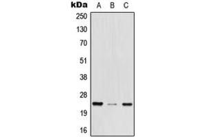 Western blot analysis of MED29 expression in HEK293T (A), mouse brain (B), rat lung (C) whole cell lysates. (MED29 antibody  (Center))