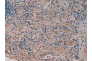 DAB staining on IHC-P; Samples: Rat Spleen Tissue (TNFRSF1B antibody  (AA 25-229))