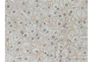 Detection of BLVRB in Human Liver Tissue using Polyclonal Antibody to Biliverdin Reductase B (BLVRB)
