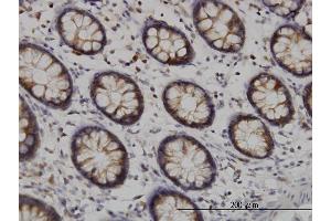 Immunoperoxidase of monoclonal antibody to TYK2 on formalin-fixed paraffin-embedded human colon. (TYK2 antibody  (AA 276-375))