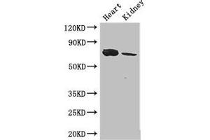 Western Blot Positive WB detected in: Mouse heart tissue, Mouse kidney tissue All lanes: MED17 antibody at 2.