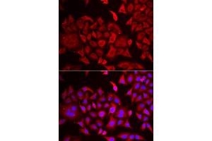 Immunofluorescence analysis of HeLa cells using TARS antibody (ABIN6132713, ABIN6148858, ABIN6148859 and ABIN6222758). (TARS antibody  (AA 1-230))
