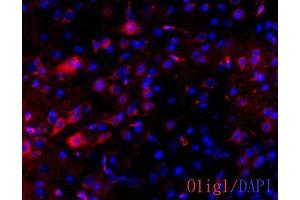 IHC-Fr Image OLIG1 antibody [C2C3] detects OLIG1 protein on adult mouse brain by immunohistochemical analysis. (OLIG1 antibody  (C-Term))
