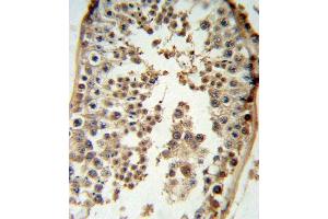 Immunohistochemistry (Paraffin-embedded Sections) (IHC (p)) image for anti-Cyclin-Dependent Kinase Inhibitor 2D (p19, Inhibits CDK4) (CDKN2D) (AA 15-43), (N-Term) antibody (ABIN6243142)