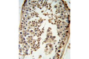 p19 Antibody (N-term) (ABIN6243142 and ABIN6579057) IHC analysis in formalin fixed and paraffin embedded testis tissue followed by peroxidase conjugation of the secondary antibody and DAB staining. (CDKN2D antibody  (N-Term))