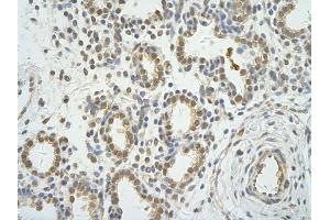 Rabbit Anti-WDR12 antibody         Paraffin Embedded Tissue:  Human Lung    cell Cellular Data:  alveolar cell    Antibody Concentration:  4. (WDR12 antibody  (C-Term))