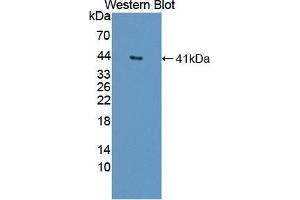Detection of Recombinant DNASEII, Human using Polyclonal Antibody to Deoxyribonuclease II (DNASEII) (Deoxyribonuclease II (AA 19-360) antibody)