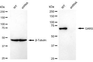 Western blotting analysis using GARS antibody (ABIN7798784).
