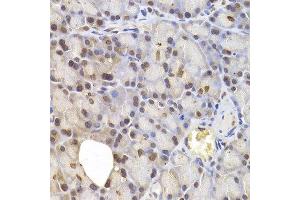 Immunohistochemistry of paraffin-embedded rat pancreas using IRF6 antibody at dilution of 1:200 (400x lens). (IRF6 antibody)