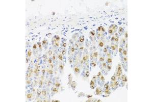 Immunohistochemistry of paraffin-embedded mouse stomach using CDC45 antibody at dilution of 1:100 (x40 lens). (CDC45 antibody)
