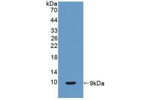 Detection of Recombinant CC16, Human using Polyclonal Antibody to Clara Cell Protein 16 (CC16) (SCGB1A1 antibody  (AA 23-91))