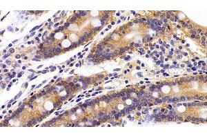 Immunohistochemistry (IHC) image for anti-Epithelial Cell Adhesion Molecule (EPCAM) (AA 25-265) antibody (ABIN7443065)