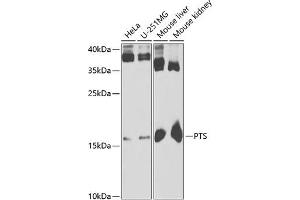 Western blot analysis of extracts of various cell lines, using PTS antibody (ABIN6129844, ABIN6146483, ABIN6146485 and ABIN6221911) at 1:1000 dilution. (PTS antibody  (AA 1-145))
