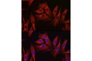 Immunofluorescence analysis of NIH-3T3 cells using HMGCR Rabbit pAb (ABIN3022293, ABIN3022294, ABIN3022295, ABIN1513022 and ABIN6218714) at dilution of 1:100 (40x lens). (HMGCR antibody  (AA 629-888))
