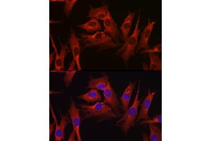 Immunofluorescence analysis of NIH-3T3 cells using HMGCR Rabbit pAb (ABIN3022293, ABIN3022294, ABIN3022295, ABIN1513022 and ABIN6218714) at dilution of 1:100 (40x lens). (HMGCR antibody  (AA 629-888))