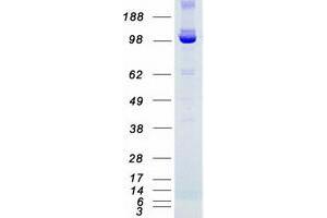 Validation with Western Blot