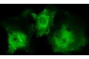 Image no. 1 for anti-Pleckstrin (PLEK) antibody (ABIN1500272)